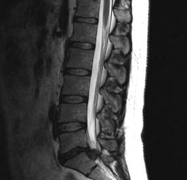 Diagnostic options for lumbar osteochondrosis