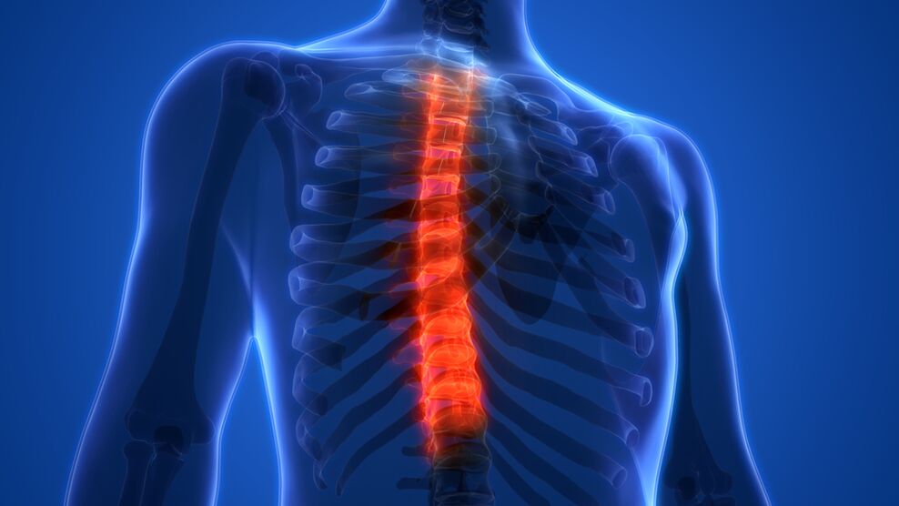 osteochondrosis of the thoracic spine