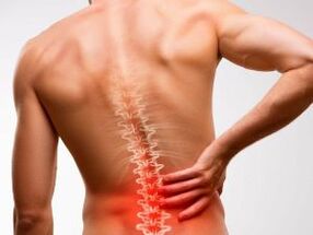 lower back pain due to osteochondrosis
